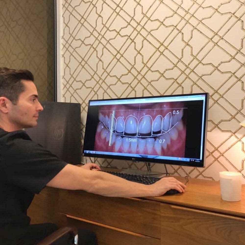 Carlos Saiz Smile -Clinica dental y diseno de sonrisa – Madrid – Barrio Salamanca – Milla de Oro – imagen 3